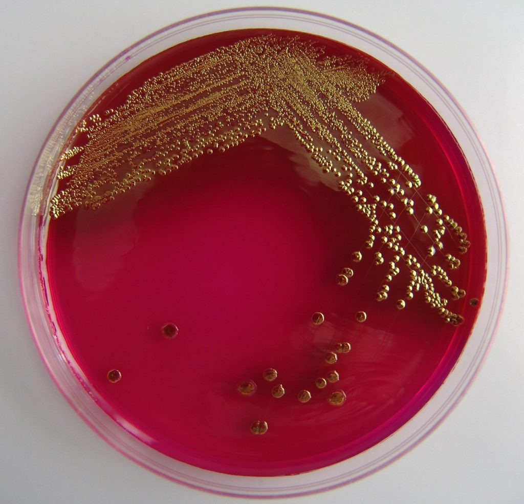 escherichia-coli-1441194-1279x1229