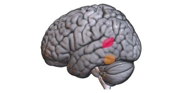 Mózg z zaznaczonymi obszarami dysortografii i dysleksji